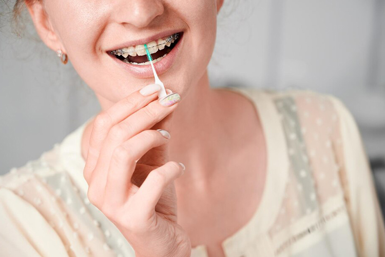 مسواک‌های بین دندانی یا اینترپروگزیمال، به‌ویژه برای دندان‌های دارای براکت بسیار مفید هستند. 